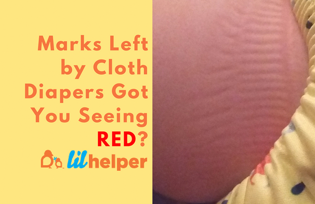 Are your Cloth Diapers Leaving Marks on your Baby’s Skin?